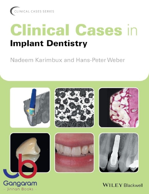 Clinical Cases in Implant Dentistry (Clinical Cases (Dentistry))