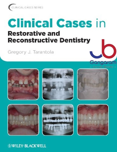 Clinical Cases in Restorative and Reconstructive Dentistry (Clinical Cases (Dentistry))