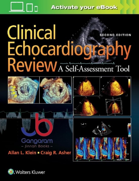 Clinical Echocardiography Review 2nd Edition