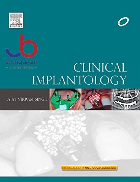 Clinical Implantology, 1e