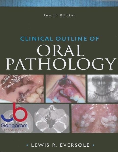 Clinical Outline of Oral Pathology