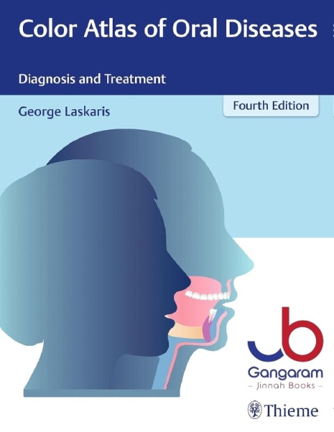 Color Atlas of Oral Diseases Diagnosis and Treatment