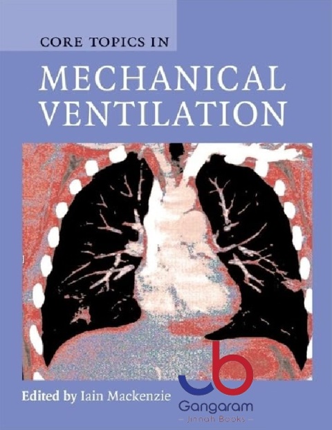 Core Topics in Mechanical Ventilation (Cambridge Medicine