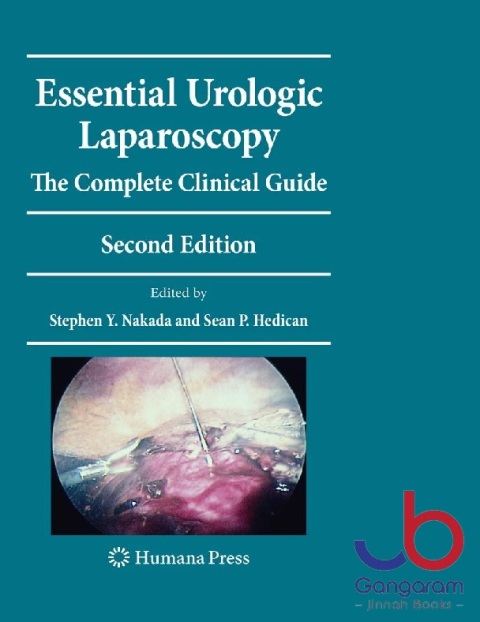 Essential Urologic Laparoscopy The Complete Clinical Guide (Current Clinical Urology)