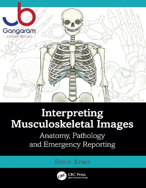 Interpreting Musculoskeletal Images Anatomy, Pathology and Emergency Reporting 1st Edition