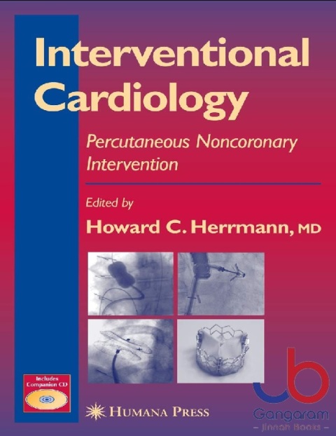 Interventional Cardiology Percutaneous Noncoronary Intervention (2)