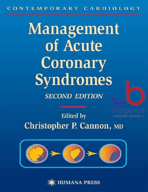 Management of Acute Coronary Syndromes (Contemporary Cardiology)