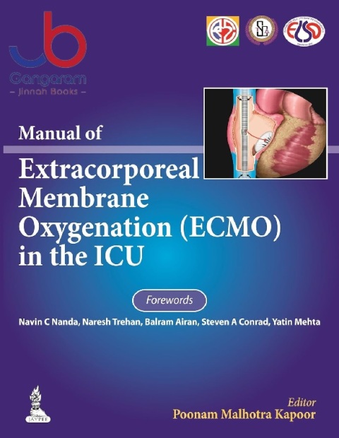 Manual of Extracorporeal Membrane Oxygenation (Ecmo) in the ICU