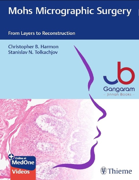 Mohs Micrographic Surgery From Layers to Reconstruction 1st Edition