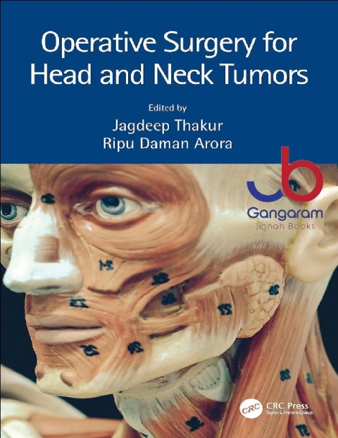 Operative Surgery for Head and Neck Tumors
