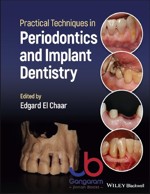 Practical Techniques in Periodontics and Implant Dentistry 1st Edition