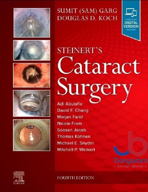 Steinert's Cataract Surgery 4th Edition