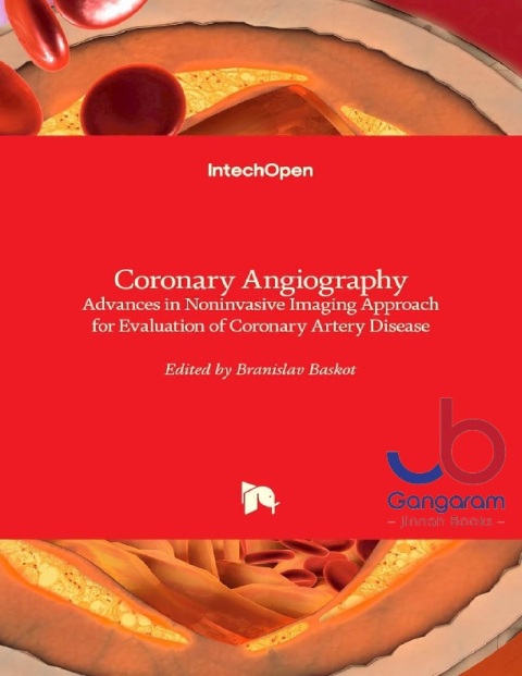 Coronary Angiography Advances in Noninvasive Imaging Approach for Evaluation of Coronary Artery Disease