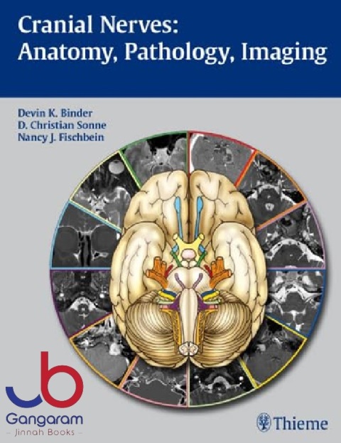 Cranial Nerves Anatomy, Pathology, Imaging