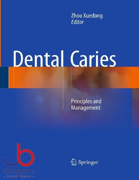 Dental Caries Principles and Management