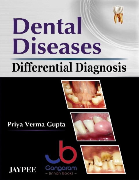Dental Diseases (Differential Diagnosis)