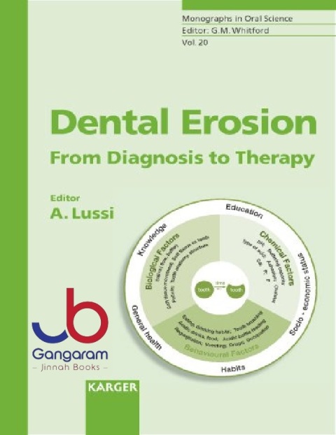 Dental Erosion From Diagnosis to Therapy (Monographs in Oral Science)
