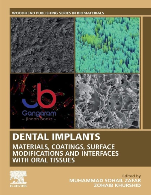 Dental Implants Materials, Coatings, Surface Modifications and Interfaces with Oral Tissues (Woodhead Publishing Series in Biomaterials)