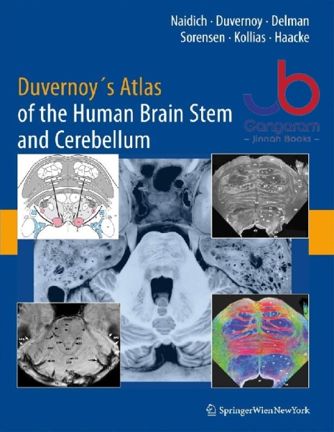 Duvernoy's Atlas of the Human Brain Stem and Cerebellum High-field MRI, Surface Anatomy, Internal Structure, Vascularization and 3D Sectional Anatomy