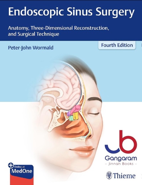 Endoscopic Sinus Surgery Anatomy, Three-Dimensional Reconstruction, and Surgical Technique