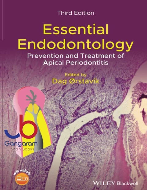 Essential Endodontology Prevention and Treatment of Apical Periodontitis