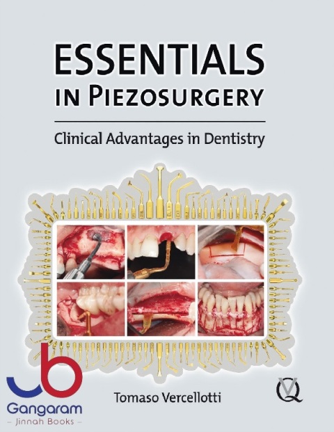 Essentials in Piezosurgery Clinical Advantages in Dentistry
