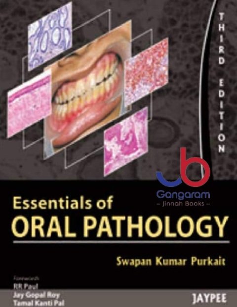 Essentials of Oral Pathology