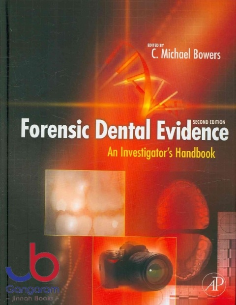 Forensic Dental Evidence An Investigator's Handbook