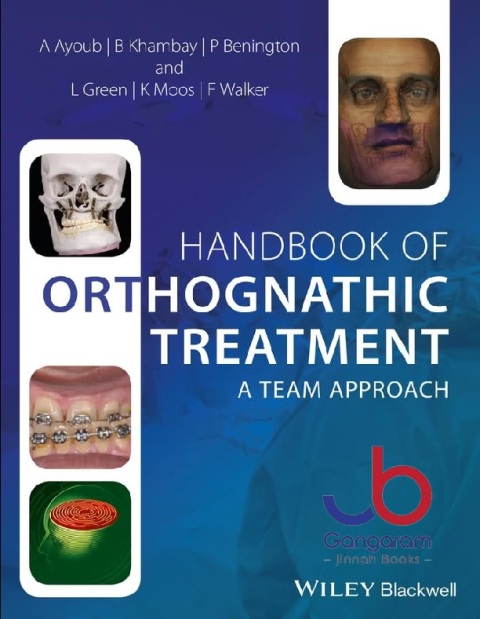 Handbook of Orthognathic Treatment A Team Approach