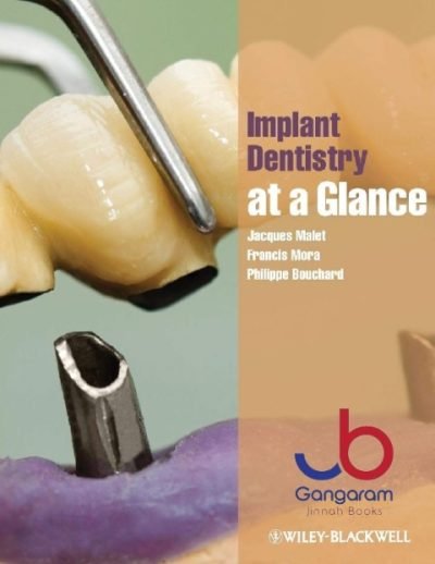 Implant Dentistry at a Glance 1st Edition