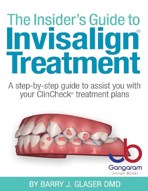 Insider's Guide to Invisalign Treatment A step-by-step guide to assist you with your ClinCheck treatment plans