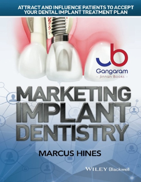 Marketing Implant Dentistry Attract and Influence Patients to Accept Your Dental Implant Treatment Plan