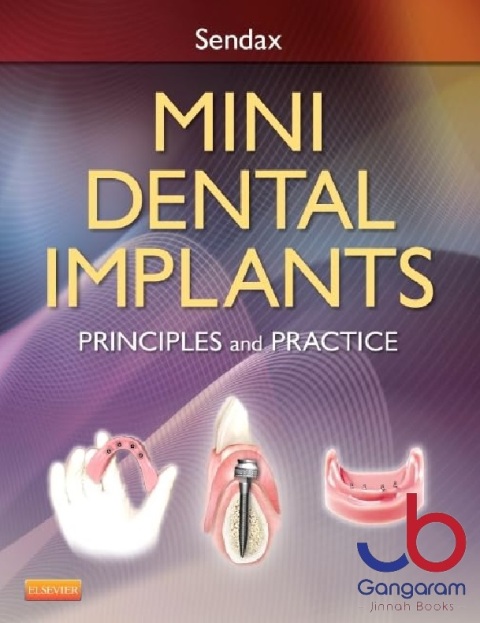 Mini Dental Implants Principles and Practice