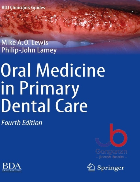 Oral Medicine in Primary Dental Care (BDJ Clinician’s Guides)