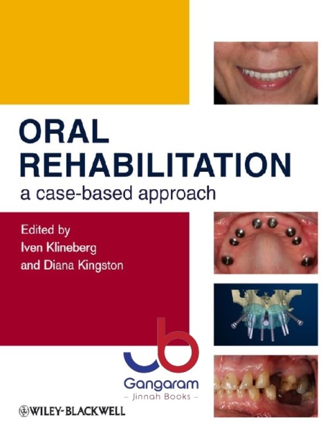 Oral Rehabilitation A Case-Based Approach