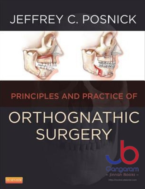 Orthognathic Surgery - 2 Volume Set Principles and Practice, 1e