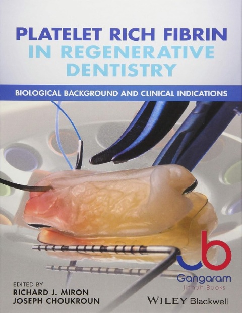 Platelet Rich Fibrin in Regenerative Dentistry Biological Background and Clinical Indications