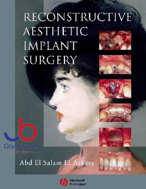 Reconstructive Aesthetic Implant Surgery