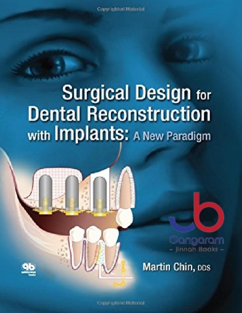 Surgical Design for Dental Reconstruction With Implants A New Paradigm