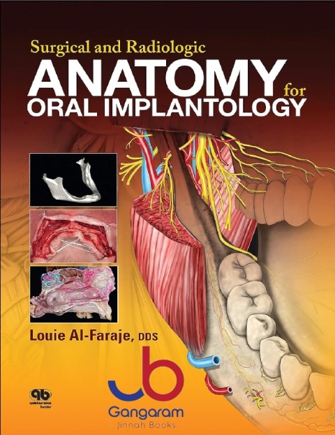 Surgical and Radiologic Anatomy of Oral Implantology