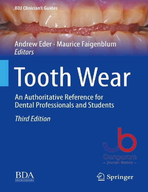 Tooth Wear An Authoritative Reference for Dental Professionals and Students (BDJ Clinician’s Guides)
