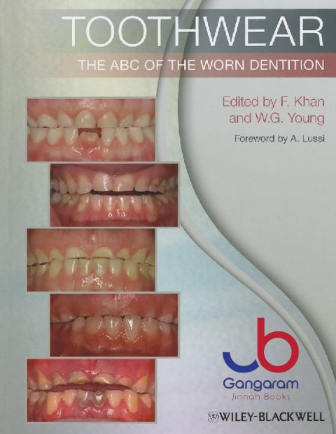Toothwear The ABC of the Worn Dentition