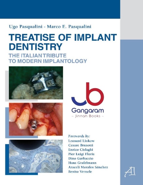 Treatise of implant dentstry. The italian tribute to modern implantology