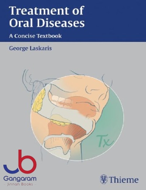 Treatment of Oral Diseases A Concise Pocket Guide