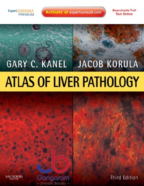 Atlas of Liver Pathology Expert Consult - Online and Print (Atlas of Surgical Pathology)