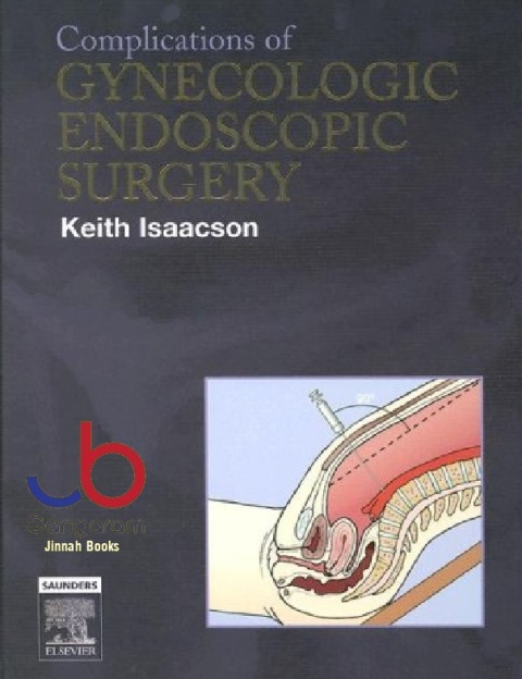 Complications of Gynecologic Endoscopic Surgery