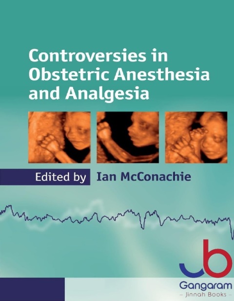 Controversies in Obstetric Anesthesia and Analgesia (Cambridge Medicine