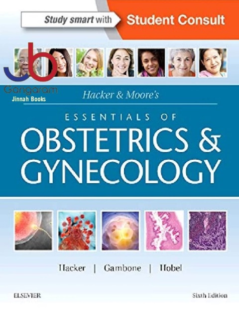 Hacker & Moore's Essentials of Obstetrics and Gynecology.