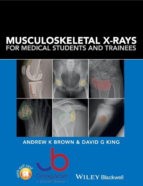 Musculoskeletal X-Rays for Medical Students and Trainees 1st Edition