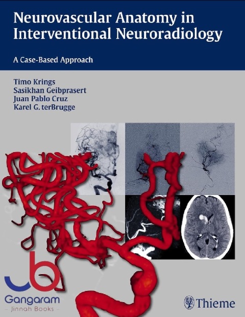 Neurovascular Anatomy in Interventional Neuroradiology A Case-Based Approach